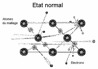 etat normal